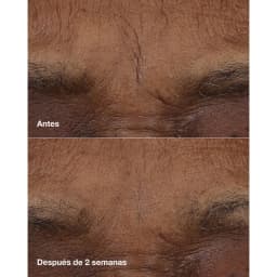 Barra De Retinol Smart Clinical Repair Clinique 3