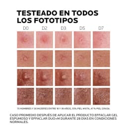 Tratamiento La Roche Posay Anti-Imperfecciones Effaclar Duo+M 40ml 3